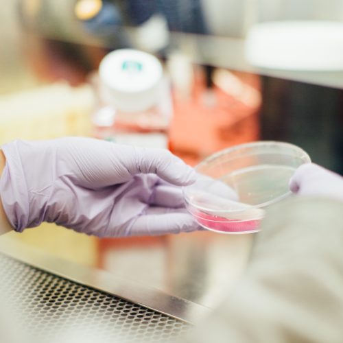 Cell culture Cell culture