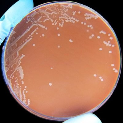 Haemophilus influenzae Haemophilus influenzae