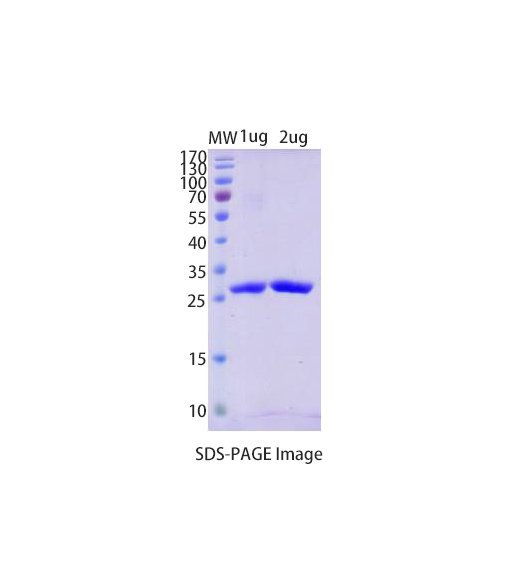 Schistosoma GST Protein Order at ProteoGenix