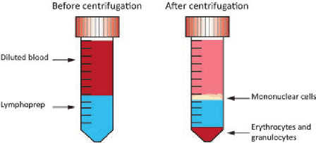 Separation-lymphoprep.png