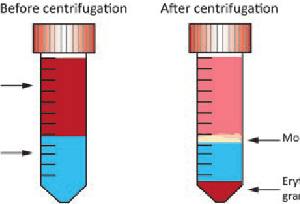 Lymphoprep™