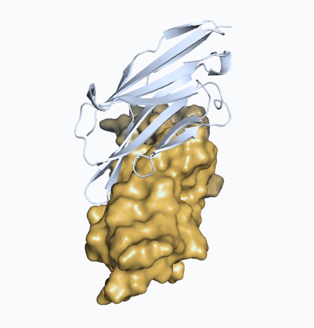 case report 3D modelisation figure 1