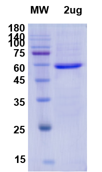 SDS-PAGE for RdRp catalytic domain of RNA-directed RNA polymerase Recombinant proteins
