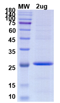 SDS-PAGE for TMPRSS2 Recombinant proteins