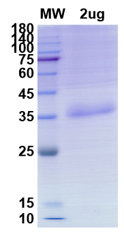 SDS-PAGE for SARS-CoV-2 RBD of Spike protein, E484K