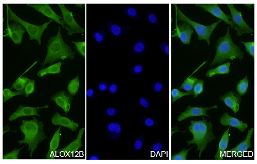 Immunofluorescence analysis of Anti-ALOX12B Polyclonal Antibody