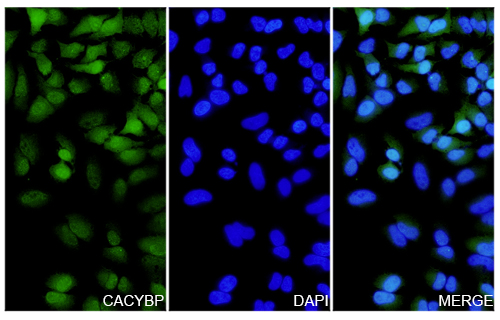 Immunofluorescence analysis of Anti-CACYBP Polyclonal antibody