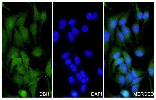 Immunofluorescence analysis of Anti-DBH Polyclonal Antibody