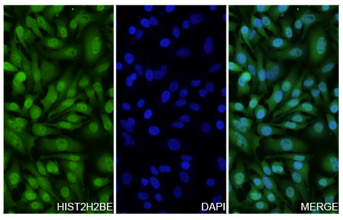 Immunofluorescence analysis of Anti-HIST2H2BE/H2BC21 Polyclonal antibody