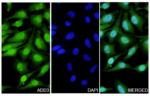 Immunofluorescence analysis of Anti-Human ADD3 Polyclonal Antibody