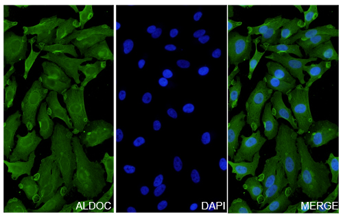 Immunofluorescence analysis of Anti-Human ALDOC Polyclonal Antibody