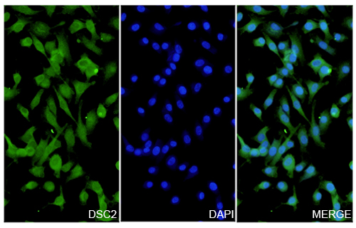 Immunofluorescence analysis of Anti-Human DSC2 Polyclonal Antibody