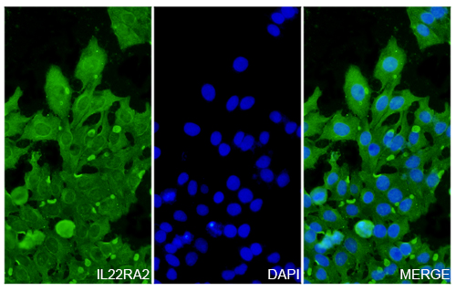 Immunofluorescence analysis of Anti-Human IL22RA2 Polyclonal Antibody