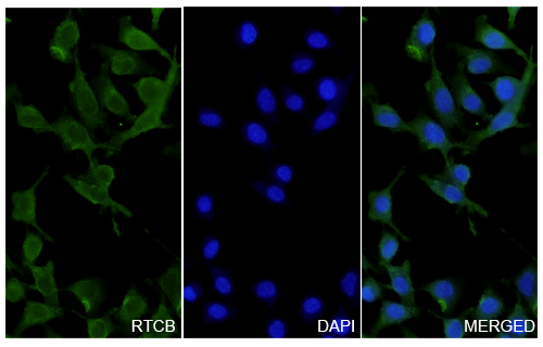 Immunofluorescence analysis of Anti-Human RTCB Polyclonal Antibody