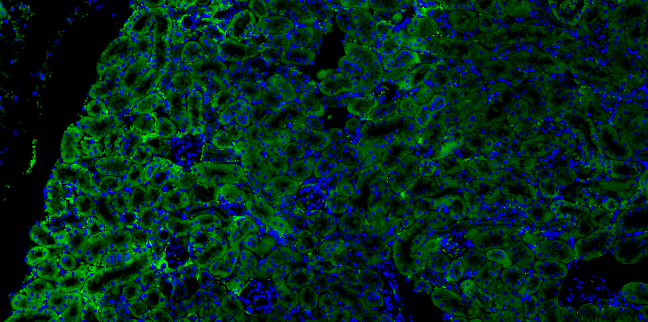 Immunofluorescence analysis of Anti-PINK1 Monoclonal Antibody (N357/6)