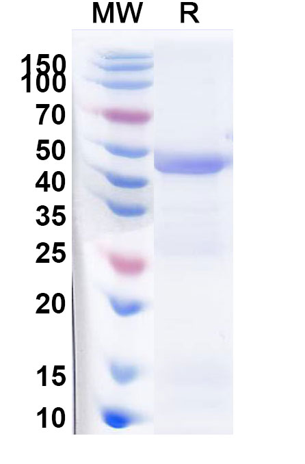 SDS-PAGE for 3-phosphoshikimate 1-carboxyvinyltransferase(aroA)