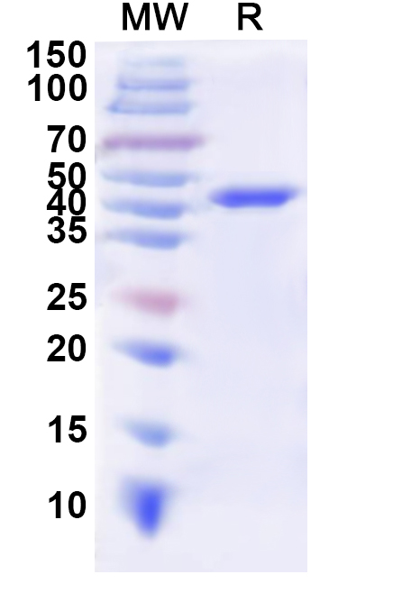 SDS-PAGE for a1AT / Serpin A1 / SERPINA1, N-His, recombinant protein