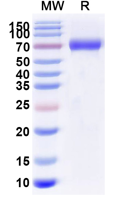 SDS-PAGE for Albiglutide Biosimilar - Anti-GLP-1 receptor fusion protein - Research Grade