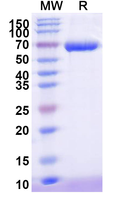 SDS-PAGE for Alpha-1-fetoprotein recombinant protein