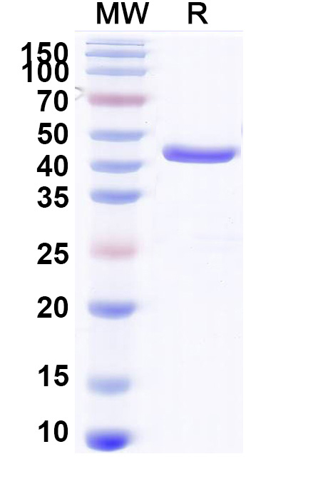 SDS-PAGE for Anti-Aflatoxin B1 Monoclonal Antibody, Nb26