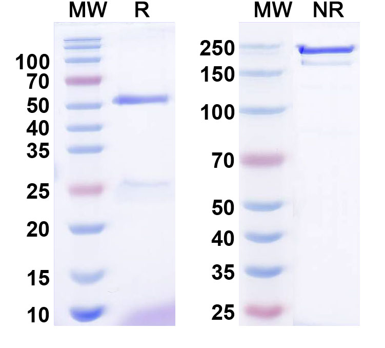SDS-PAGE for Anti-ANO10/TMEM16K Antibody (N475A/17)