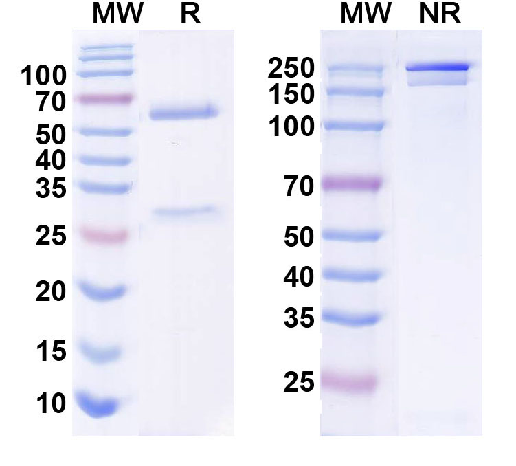 SDS-PAGE for Anti-ANO3/TMEM16C Antibody (N454/55)