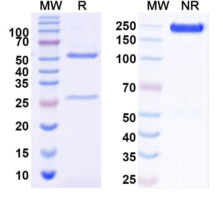 SDS-PAGE for Anti-ANO6/TMEM16F Antibody (N429/14)