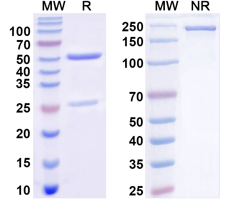 SDS-PAGE for Anti-Bacillus anthracis PA/pagA/PA-83 Antibody (SAA1377)