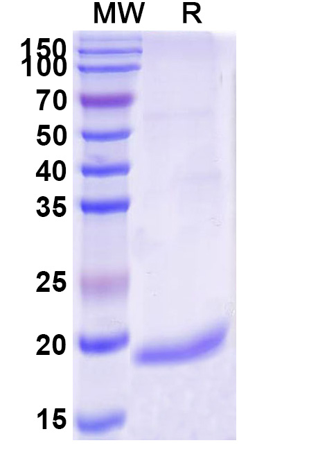 SDS-PAGE for Anti-Bacillus anthracis PAD4 VHH (VHH10)