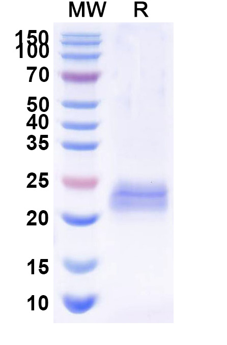 SDS-PAGE for Anti-Bacteriophage 933W stxB2/SLT-2b/VT2 VHH (Nb113)