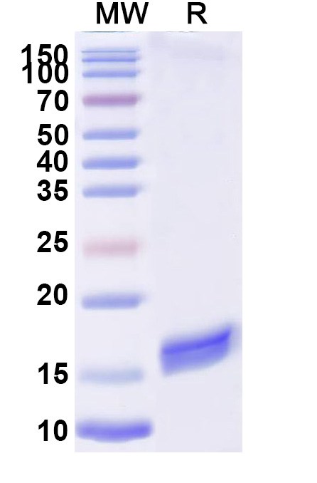 SDS-PAGE for Anti-Bacteriophage H19B stxB/SLT-1b/VT1 VHH (7-2#)