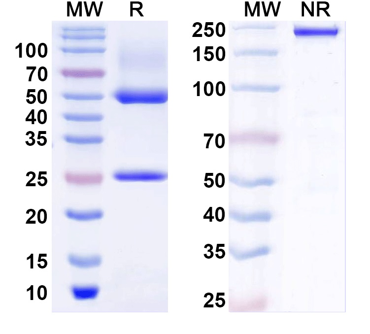 SDS-PAGE for Anti-BBS1 Antibody (N292/13)