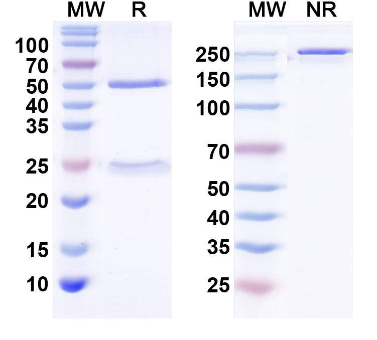 SDS-PAGE for Anti-BBS3/Arl6 Antibody (N302/10)