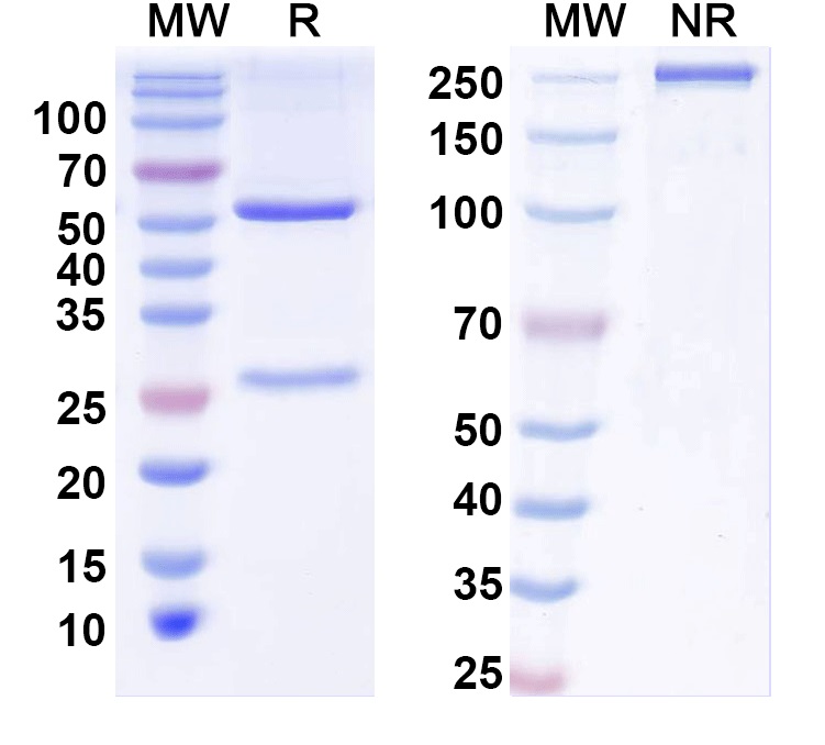 SDS-PAGE for Anti-BBS5 Antibody (N304B/115)