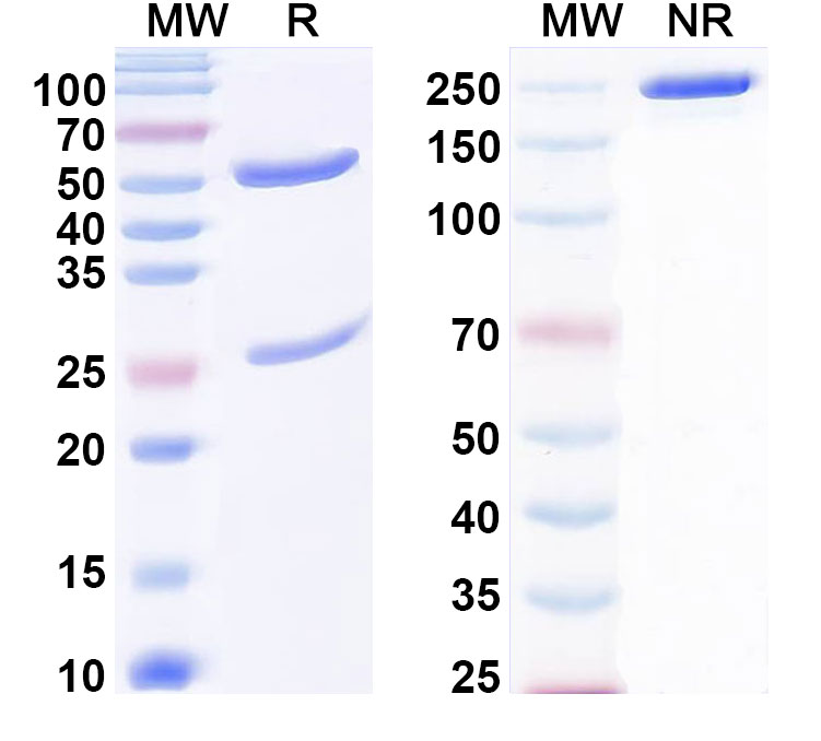SDS-PAGE for Anti-Bet v 1/Allergen Bet v I-A Antibody (SAA0660)