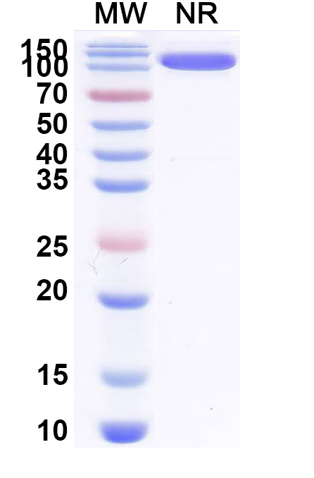 SDS-PAGE for Anti-Bet v 1/Allergen Bet v I-A Antibody (SAA0668)