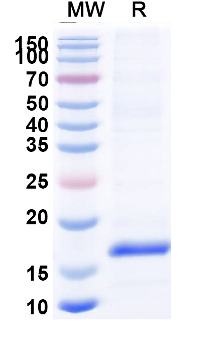 SDS-PAGE for Anti-Bet v 1/Allergen Bet v I-A VHH (SAA0668)
