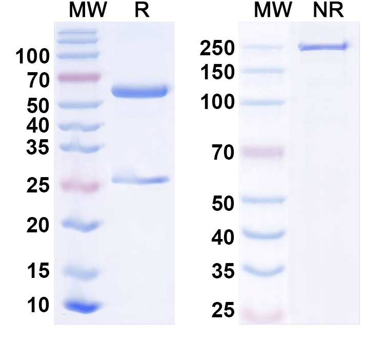 SDS-PAGE for Anti-BETVII/Allergen Bet v II Antibody (SAA0670)