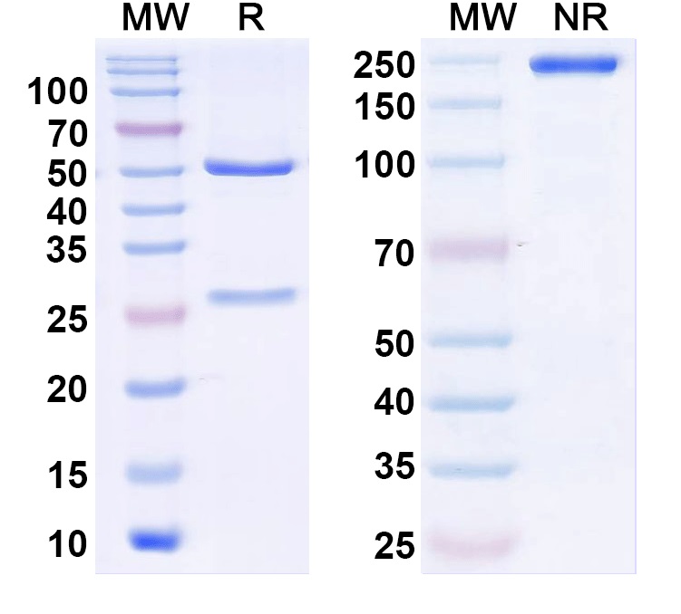 SDS-PAGE for Anti-BKbeta4 K+ channel Antibody (L18A/3)
