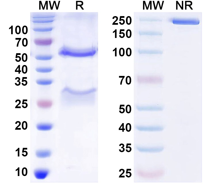 SDS-PAGE for Anti-Blomia tropicalis (Mite) Blo t 5/BLOT5 Monoclonal Antibody (101-D-12)