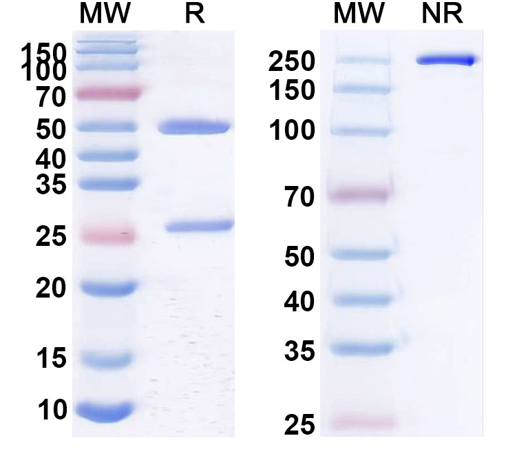 SDS-PAGE for Anti-Borreliella burgdorferi DbpA Antibody (SAA2344)