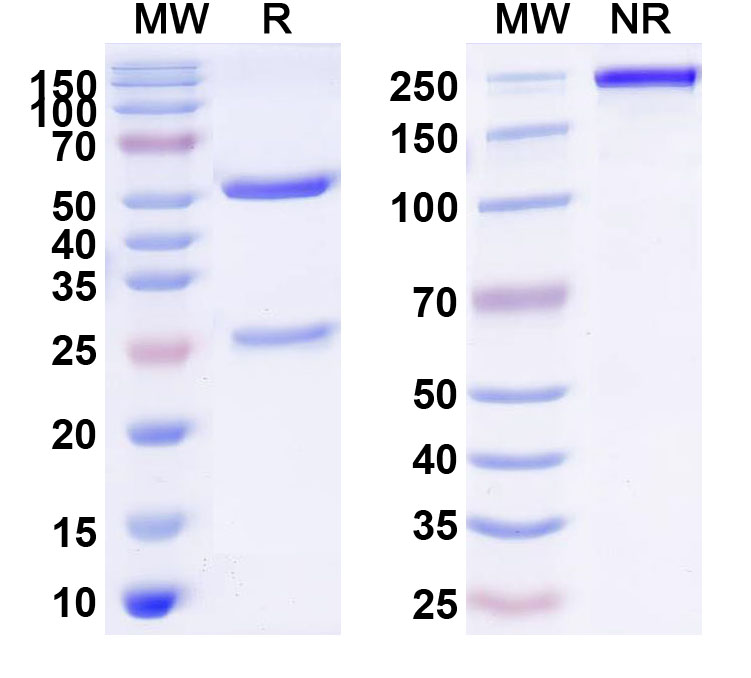 SDS-PAGE for Anti-Borreliella burgdorferi ospA Antibody (SAA2243)