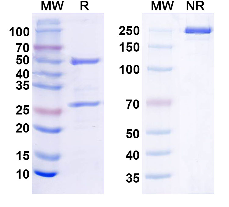 SDS-PAGE for Anti-Brevican Antibody (N294/21)