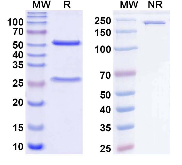 SDS-PAGE for Anti-C.difficile Toxin A/tcdA Monoclonal Antibody, SAA1378