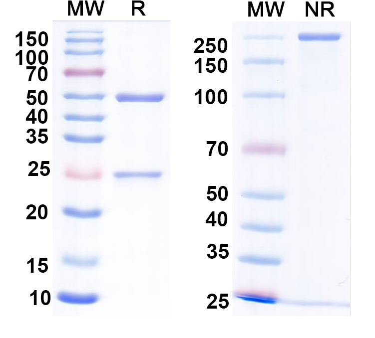 SDS-PAGE for Anti-Calretinin Antibody (L122/6)