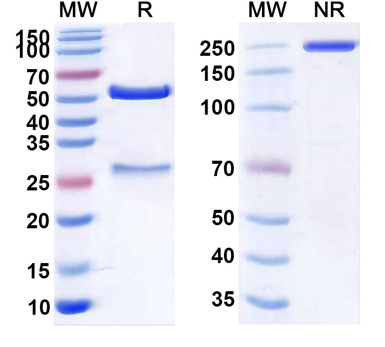SDS-PAGE for Anti-Cardiolipin Antibody (SAA2404)