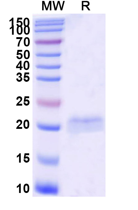 SDS-PAGE for Anti-Castor bean Ricin VHH (SAA0878)