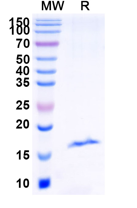 SDS-PAGE for Anti-Castor bean Ricin VHH (SAA0983)