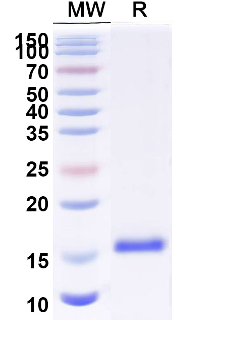 SDS-PAGE for Anti-Castor bean Ricin VHH (SAA0984)