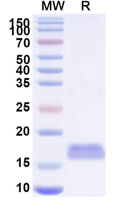 SDS-PAGE for Anti-Castor bean Ricin VHH (SAA0985)